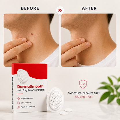 DermaSmooth™ Skin Tag Remover Patches